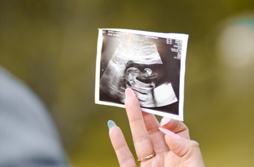 Se din baby i maven til en scanning