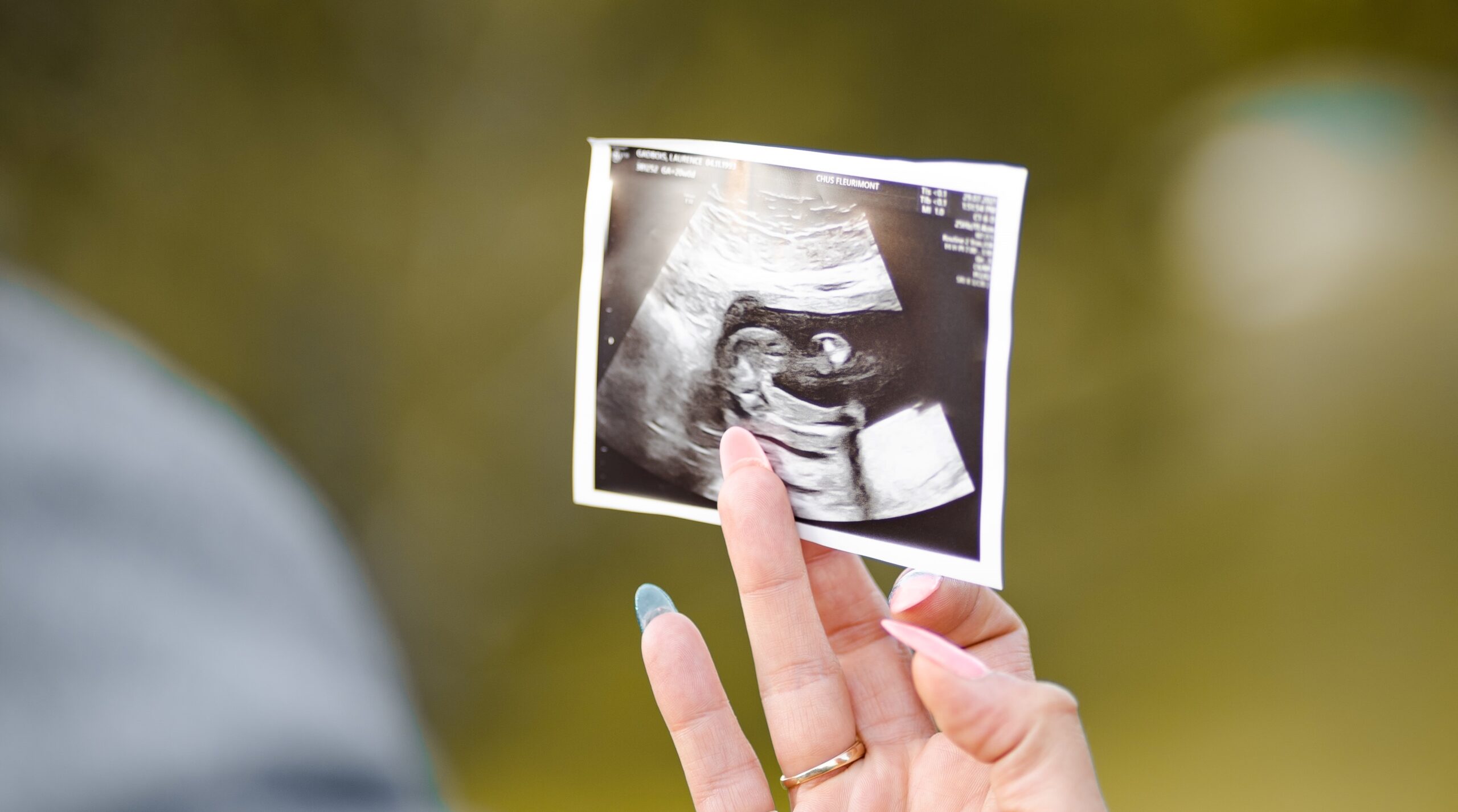 Se din baby i maven til en scanning